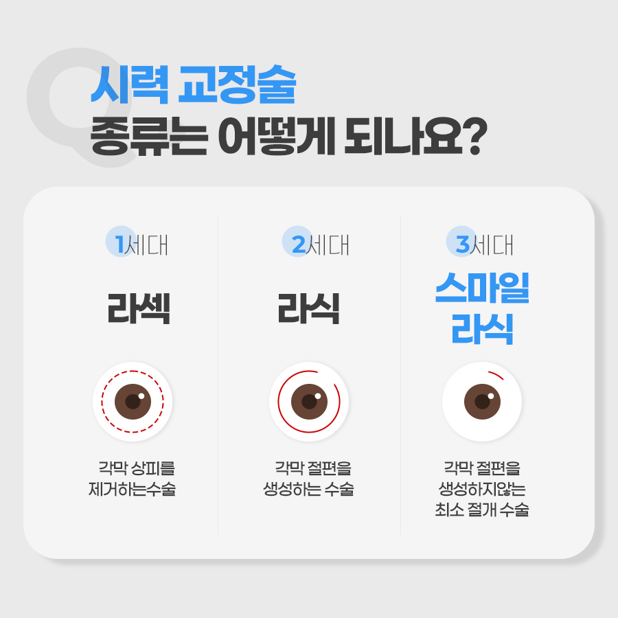 시력 교정술 종류는 어떻게 되나요?