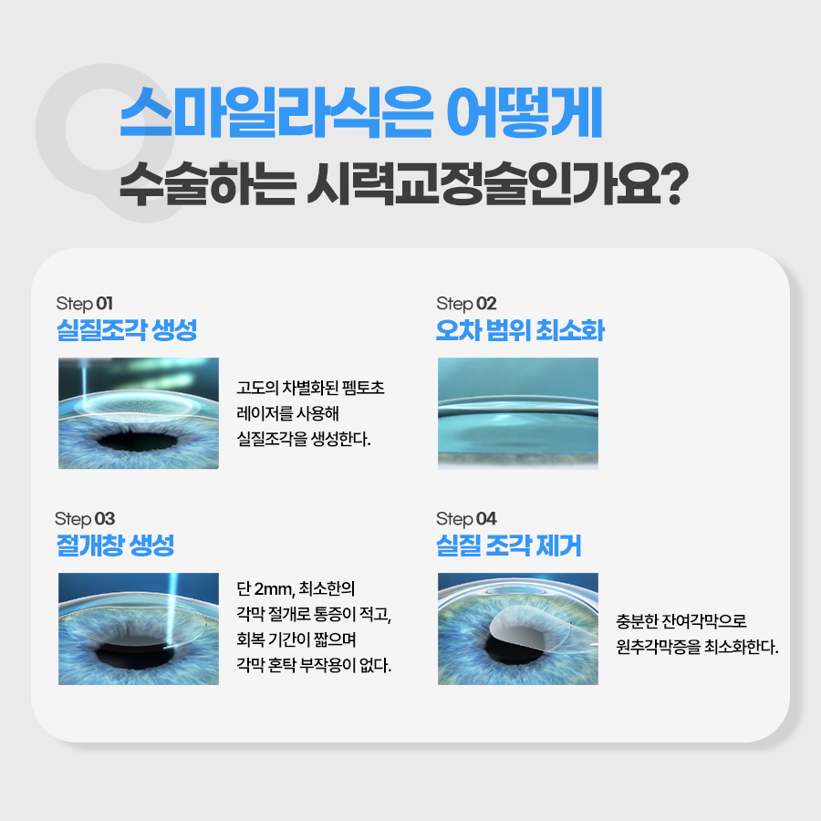 스마일라식은 어떻게 수술하는 시력교정술인가요?